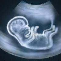 Op welke datum vertoont echografie zwangerschap?